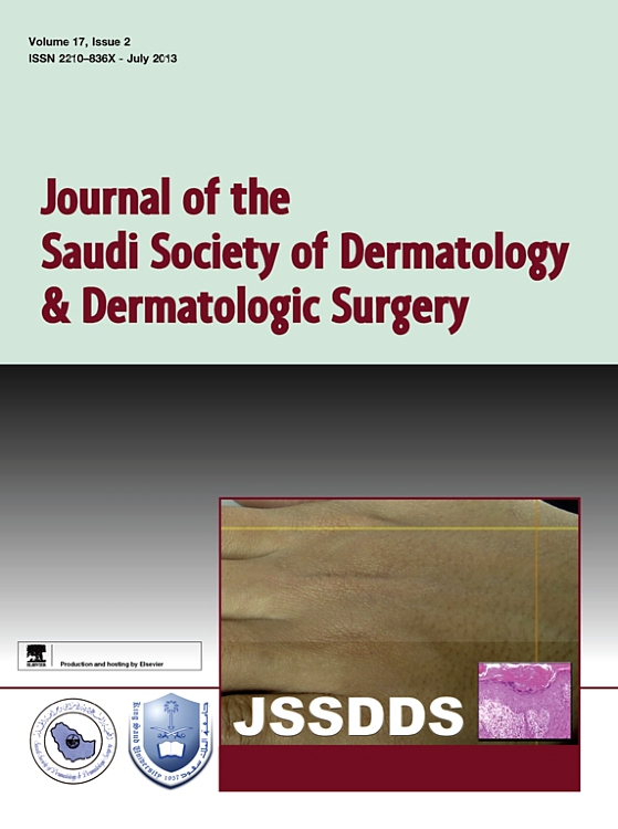 Go to journal home page - Journal of the Saudi Society of Dermatology & Dermatologic Surgery